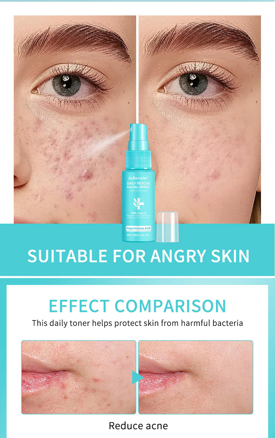 Facial Spray